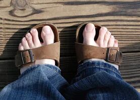 Healthy feet in sandals