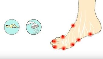 causes of toe fungus