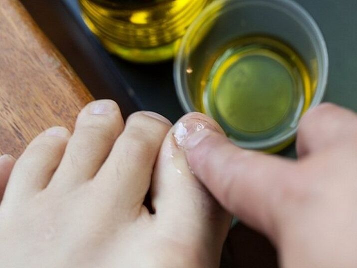 Application of medicated oil to nails affected by fungus