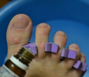 Preparing to treat nails with antifungal drops